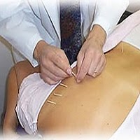 Acupuncture UK affordable 721849 Image 0